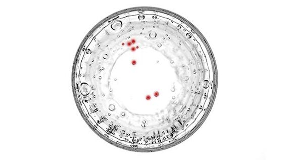 Se tes síntomas de prostatite, debes facerte unha proba de infeccións ocultas.